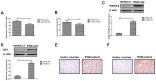Posted by susan2018 @susan2018, sep 7, 2019. Application Of A Novel Targeting Nanoparticle Contrast Agent Combined With Magnetic Resonance Imaging In The Diagnosis Of Intraductal Papillary Mucinous Neoplasm
