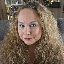 What are effective weight loss methods for individuals with health  conditions like Chiari malformation?