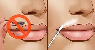 How to remove unwanted facial hair with home remedies and methods. This Unique Russian Home Remedy Will Help You To Get Rid Of Facial Hair Within No Time Neopress