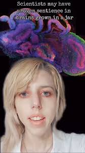 Repost from @bearbaitofficial, Would you want parts of your brain to keep  living in simulated realities after you’re dead? , “​​Organoids are  carefully grown collections of cells in a dish, designed ...