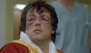 Check spelling or type a new query. Losing Boxer Ends Fight With An Unbelievably Swollen Eye For The Win