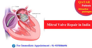 Attractive Packages For Qatar Patients For Mitral Valve Repair In India Mitral Valve Repair Mitral Valve Valve
