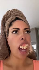 Jasmine Secrest Teeth