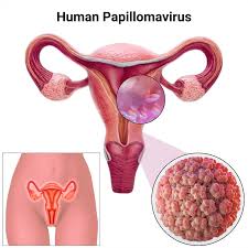 Image result for human papillomavirus symptoms