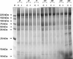 New users enjoy 60% off. Protein Profile Of Red Blood Cells After Storage And Irradiation Download Scientific Diagram