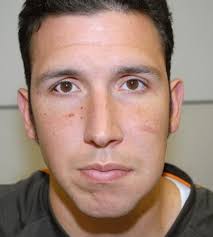 Police chief stands by officer after settlement in fatal shooting