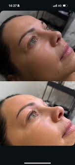 Looking for someone that can fit and supply composite or aluminium gate and  actually turns up thanks