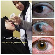 Ianya terletak didalam dan bukan di luar permukaan mata. Tips Merawat Masalah Rabun Dan Selaput Mata Posts Facebook