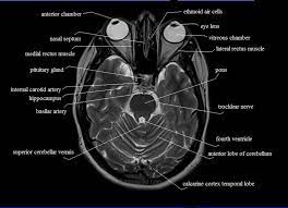 Mri Anatomy Brain Axial Image 9 Brain Anatomy Mri Brain Anatomy