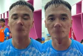 VPF: 'Xuân Nam chủ động gây hấn'