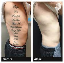 Although the amount that it will cost to remove your tattoo will vary from person to person, you can generally expect to pay roughly $200 to $500 per treatment. 7 Factors That Determine The Cost Of Your Tattoo Removal Tattoo Cares