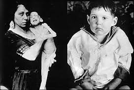 In 1920, canadian surgeon frederick banting visited. 80 Jahre Insulin