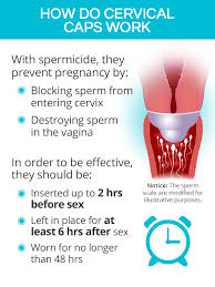 Image result for Cervical Cap