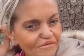 EastEnders' Danniella Westbrook goes makeup free after denying nose job  claims - My London