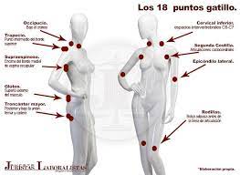 Los puntos gatillo o puntos dolorosos son vistos como las áreas del cuerpo que son más sensibles al tacto, y esto es más común en condiciones de fibromialgia. Fibromialgia Causa De Incapacidad Permanente Fibromialgia Puntos Fibromialgia Puntos Gatillo Fibromialgia