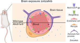 Image result for ALK Inhibitor