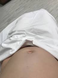 Ovarian cancer (cancer of the ovaries). Hzm7bbtlvxvcym