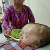 Antaranya ialah jangkitan virus seperti shingles, mumps atau herpes simplex. Https Encrypted Tbn0 Gstatic Com Images Q Tbn And9gctx4slvawwifa9lppatgl5zkohkdvi0ga1donfzhs5ukx8snsag Usqp Cau