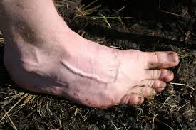 Pages in category american folk rock groups the following 200 pages are in this category, out of approximately 206 total. Barefoot Forward The Revolution A Repost To Bbc Dissected The Incredible Human Hand And Foot Farafoot Bushcraft