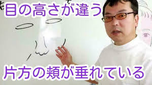 目の高さが違う片方の頬が垂れて違和感がある 頬 目 対処