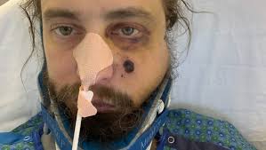 Fundraiser for Justin McGill by Chelsea Wilde : Support Justin's Recovery  From Taking a Bullet to the Face