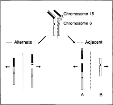 Prader Willi Syndrome And Angelman Syndrome In Cousins From