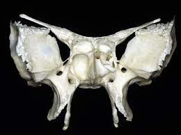 Sphenoid bone ex situ & in situ. Anterior View Of Sphenoid Bone Neuroanatomy The Neurosurgical Atlas By Aaron Cohen Gadol M D