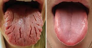 Image result for Tongue