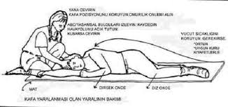 Yazımızda konu ile ilgili kapsamlı bilgilere yer vereceğiz. Heimlich Manevrasi Ve Hayat Kurtarma Asil Susan Kaybeder