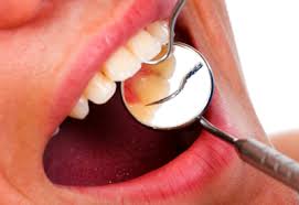 Gum Surgery Osseous Surgery Tupelo Ms