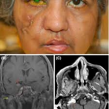 Lily Koo Lin's research works