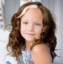 Course Medg550 Student Activities Waardenburg Syndrome Type I Ubc Wiki
