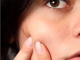 Surgical procedures can get rid of them more quickly. The Best Products To Get Rid Of Acne Scars