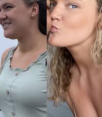 THE BEST 10 OPHTHALMOLOGISTS near JOHNSTON, RI