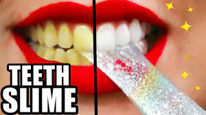 Constant application of whitening strips has been shown to cause i have used whitening toothpaste, white strips, coconut oil pulling and activated coconut shell charcoal. Diy Teeth Whitening Slime Whiter Teeth In 2 Minutes Natalies Outlet Youtube