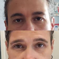 John Aker Aesthetics