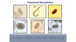 diagnostic features of intestinal nematodes