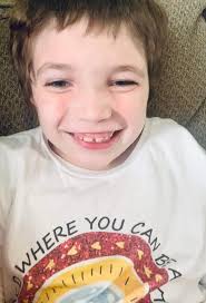 It hides behind symptoms of autism, a silent syndrome, and only a few dozen  people in the world are known to have it, but researchers expect the real  number of those with