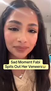 Fabi Teeth Before and After