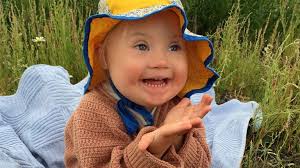 Mor til barn med Downs: Vi valgte ikke Sally til. Hun kom til os