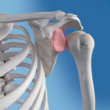Image result for Chronic Shoulder Dislocation