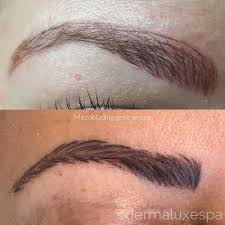 What happens when eyebrow tattoos go wrong, very wrong. Microblading Gone Wrong What S Good To Know Pmuhub