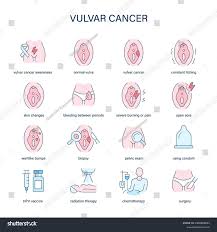 Image result for Vulvar Cancer