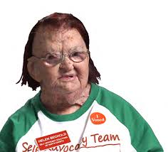 30 Years of Community Living for Individuals with Intellectual and/or  Developmental Disabilities (1987-2017)