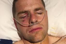 Rugby league urged to ban shoulder charge in wake of player James  Ackerman's death