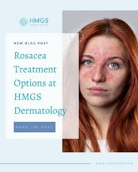 HMGS Dermatology