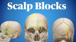 Image result for Forehead Regional Block
