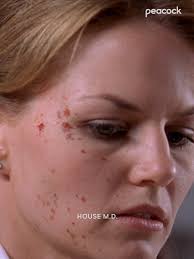 Dr. Cameron's Life-Altering Cough in House MD