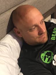 Who else with a bald head has a sweet sunburn like mine? My wife won't stop  making fun of me 🙄