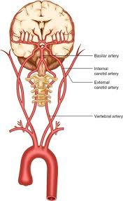 How is carotid artery disease treated? Neck Semi Supine Springerlink